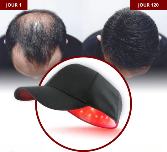 Casquette de thérapie par lumière rouge