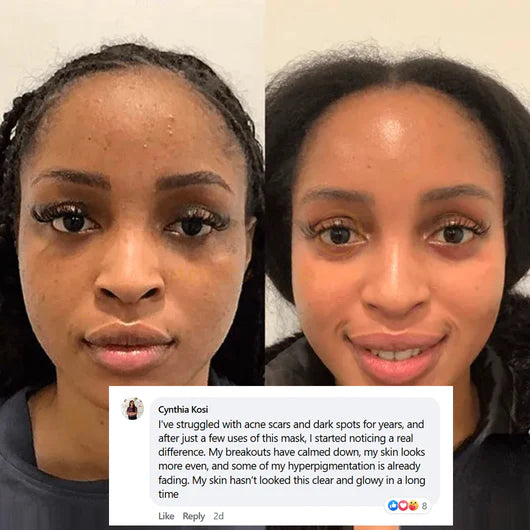 Μάσκα Νύχτας με Κολλαγόνο